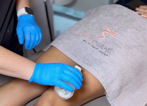 YouEstetik Lazer Epilasyon 3